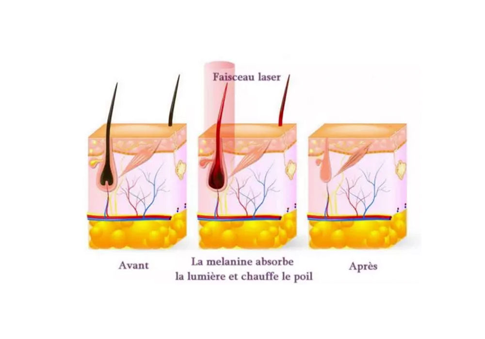 Questions fr&eacute;quentes